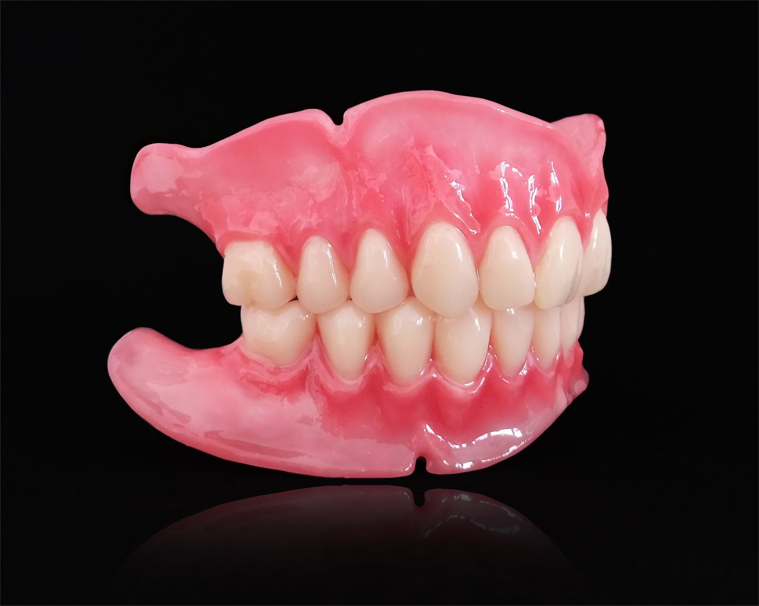 Removable Restorations - Dentures -